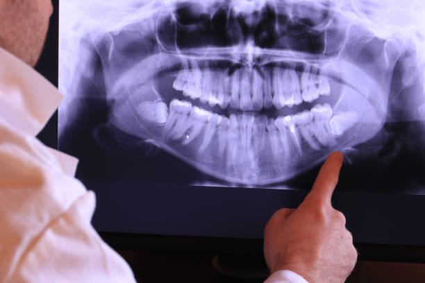 Best Emergency Gum Treatment in Seven Lakes, NC
