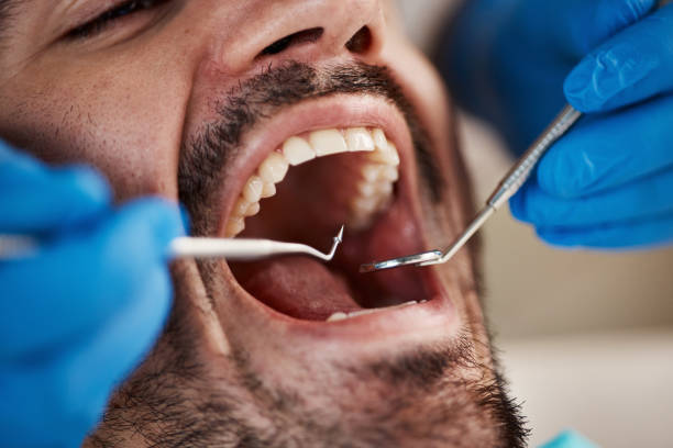 Best Emergency Treatment for Dental Infections or Abscesses in Seven Lakes, NC